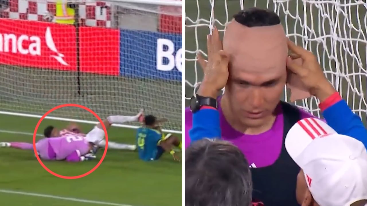 Aldair Quintana (der.), portero de la Selección Colombia, sufrió un fuerte golpe en el juego ante Paraguay.