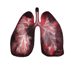 ¡Tome nota! Estas son las señales que indican que sus pulmones están fallando