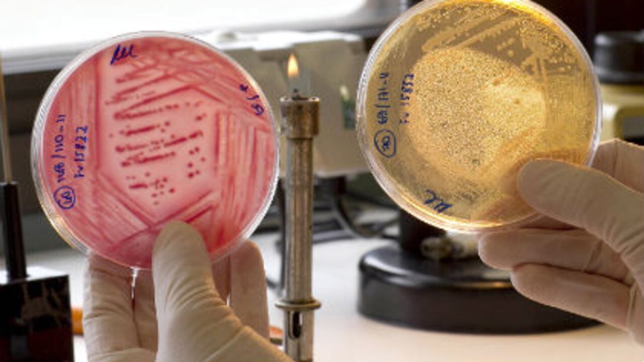 En Alemania, una investigadora analiza muestras de vegetales tras la alerta sanitaria del brote de la bacteria E. coli.