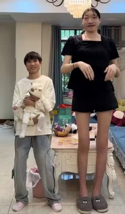 Falleció a los 26 años la creadora de contenido que se hizo viral por la diferencia de estatura con su pareja