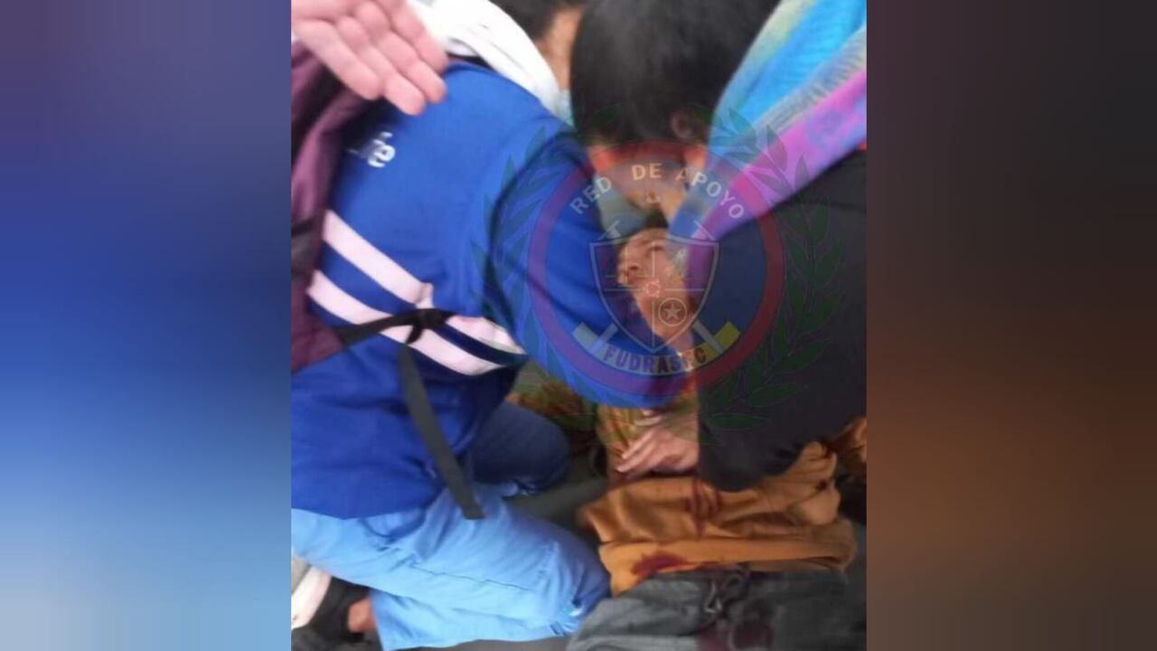 Un usuario de TRansMilenio fue herido con arma blanca por delincuentes que pretendían hurtarle sus pertenencias.