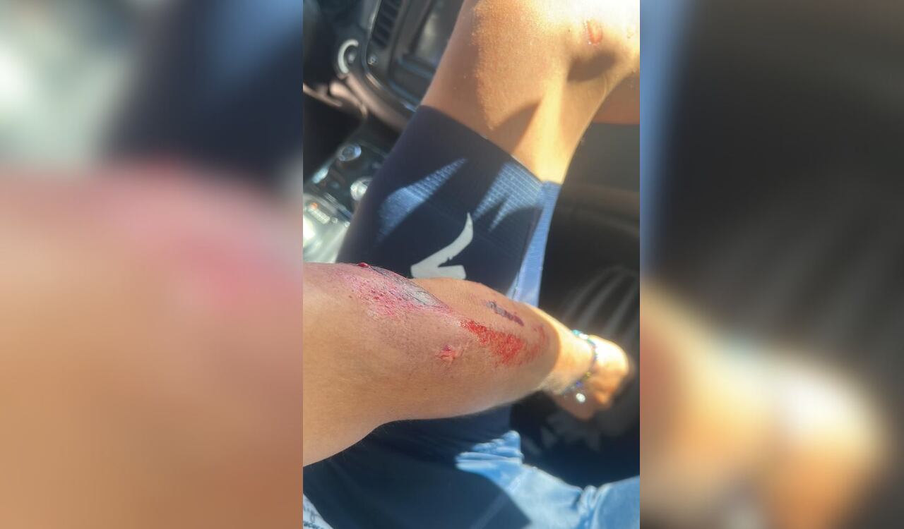 Las duras imágenes de su caída en el Tour de Gila.