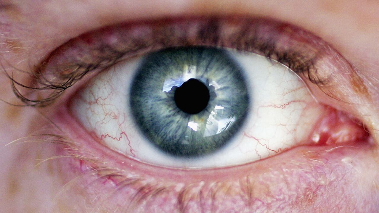 Los problemas oculares se pueden disminuir gracias a una buena alimentación.