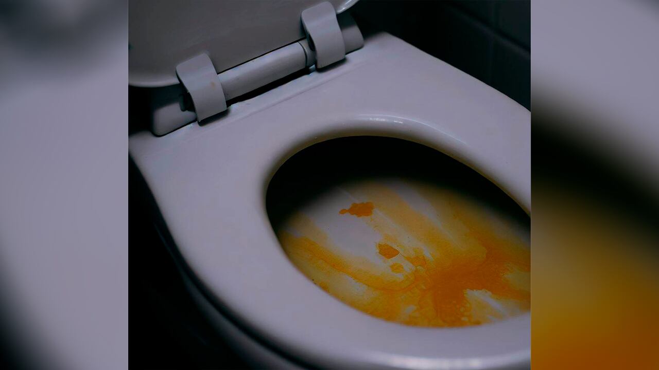 Hay varios remedios caseros para desaparecer las manchas amarillas en la tasa del baño.