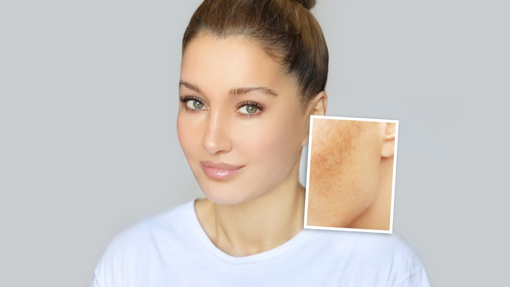 Consejos para eliminar las manchas en la piel