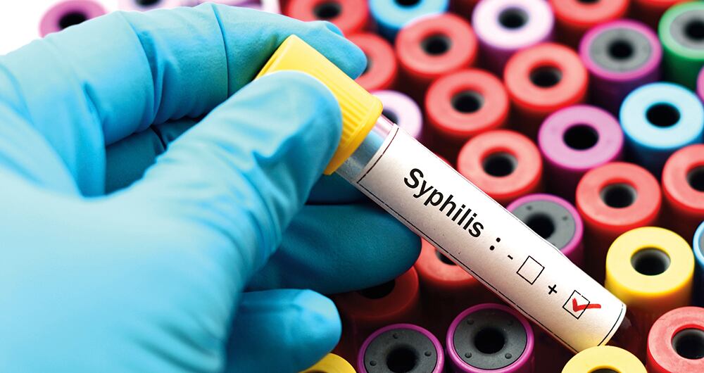 El país más afectado por esta enfermedad en la región es Argentina. 