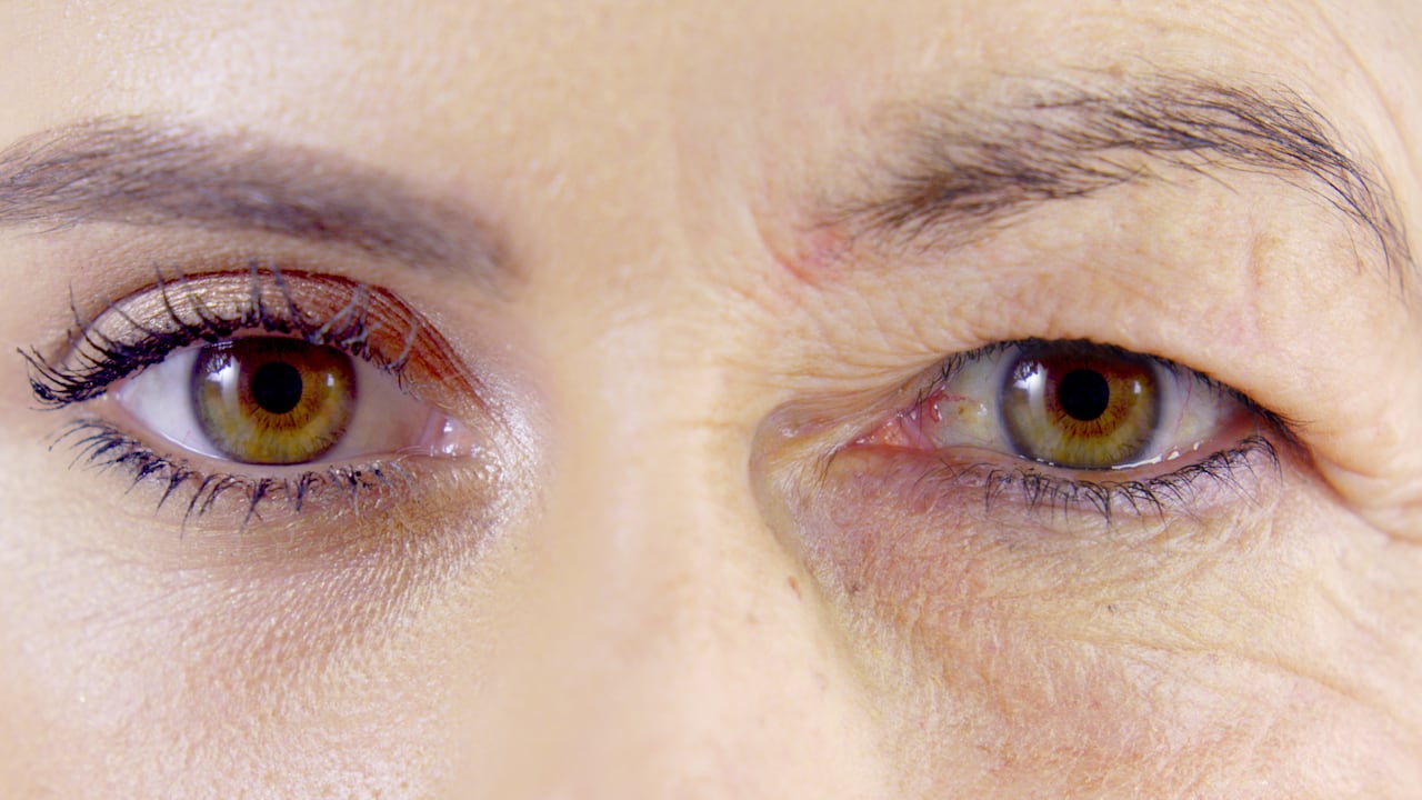 Con el tiempo, el cuerpo disminuye la producción de colágeno, el cual brinda elasticidad a la piel.