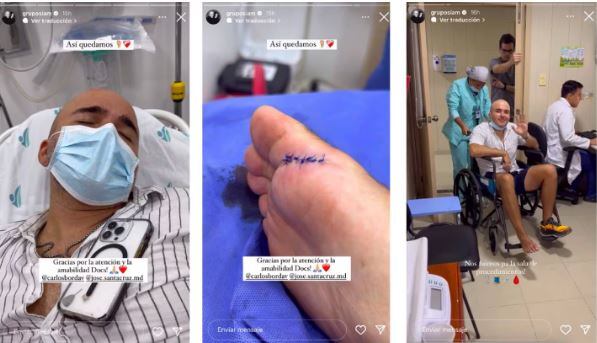 El cantante de SIAM mostró qué le pasó