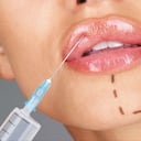 Los labios es una de las partes donde las personas más se inyectan biopolímeros. El relleno más utilizado para aumentar su volumen es el aceite de silicona.