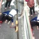 La persona que estuvo a punto de colarse en la estación de Fucha, perdió parte de su pierna izquierda.