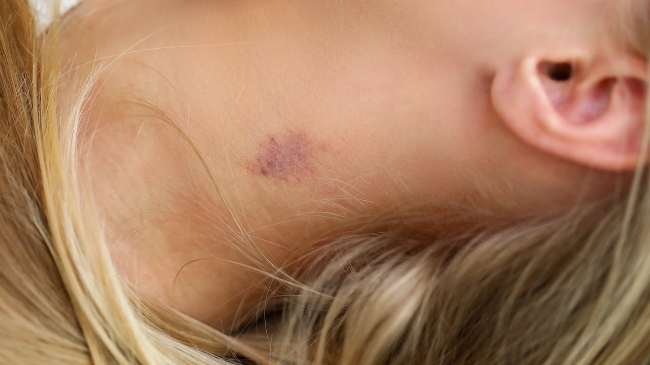 La historia le ha dado la vuelta al mundo.