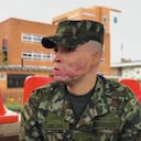 El subteniente del Ejército Nacional de Colombia Miguel Ángel Mejía, quien sobrevivió a fuertes quemaduras.