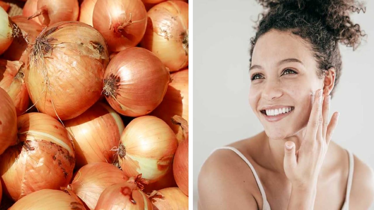 La cebolla tiene propiedades cicatrizantes que serán los mejores aliados para poder eliminar las marcas en la piel.