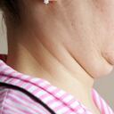 El exceso de peso es una de las principales causas de la papada.