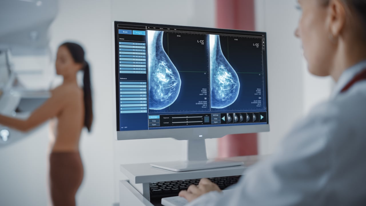 La prevención y la detección temprana son fundamentales para el diagnóstico del cáncer de mama.