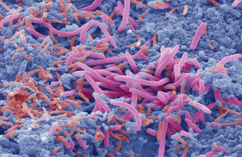 Algunos tipos de bacteria, como el estreptococo, se adhieren firmemente a las encías. Esto puede provocar enfermedades como gingivitis que a su vez conduce a la pérdida de dientes.