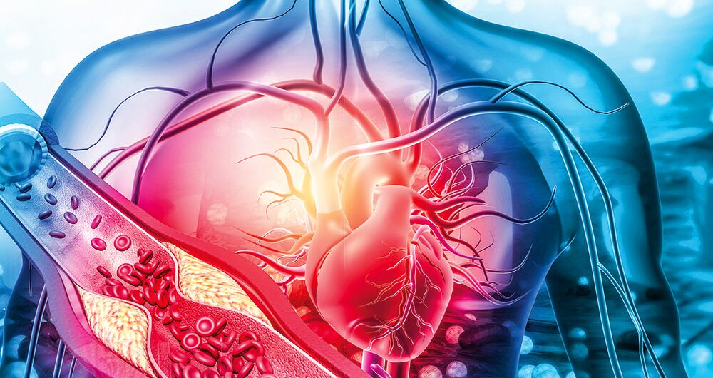 El estudio publicado en JAMA Cardiology entre más tiempo tenga niveles altos de colesterol LDL, mayor será el riesgo de sufrir un ataque cardiaco. 