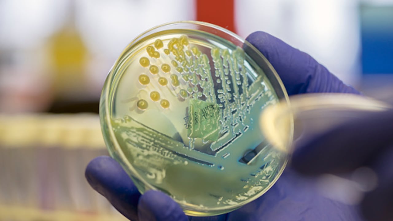 Se trata de un fenómeno en el que bacterias, virus, hongos y parásitos desarrollan la capacidad de resistir medicamentos previamente efectivos.