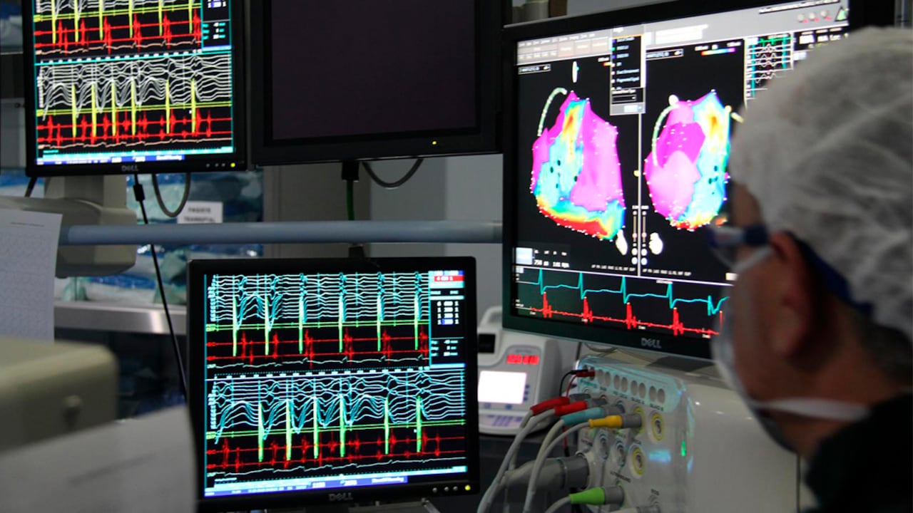 La arritmia cardíaca es una alteración en el ritmo eléctrico del corazón y se puede presentar con cambio en las frecuencias de los latidos del corazón.