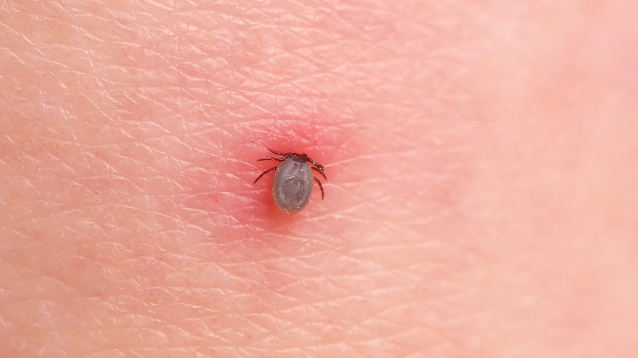 Foto de referencia sobre garrapatas en la piel