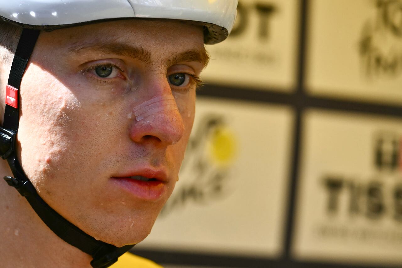UAE Team Emirate - XRG team's Slovenian rider Tadej Pogacar awaits the start of the 13th stage of the 112th edition of the Tour de France cycling race, 10.9 km individual time trial between Loudenvielle and Peyragudes, in the Pyrenees mountains of southwestern France, on July 18, 2025. (Photo by Marco BERTORELLO / AFP)