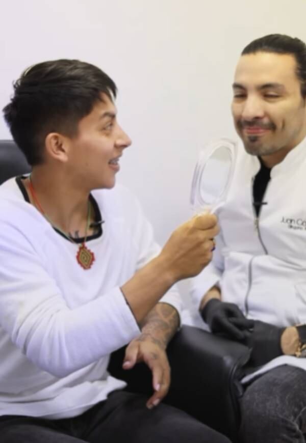 Yan Pizo se realizó inesperada cirugía en el rostro.