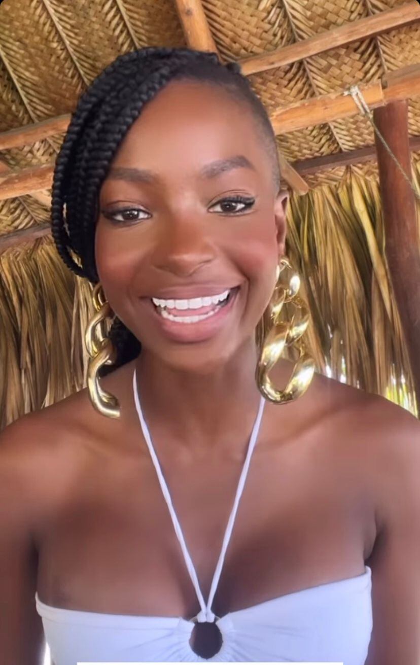 Lina María Hurtado habló de sus intervenciones estéticas.