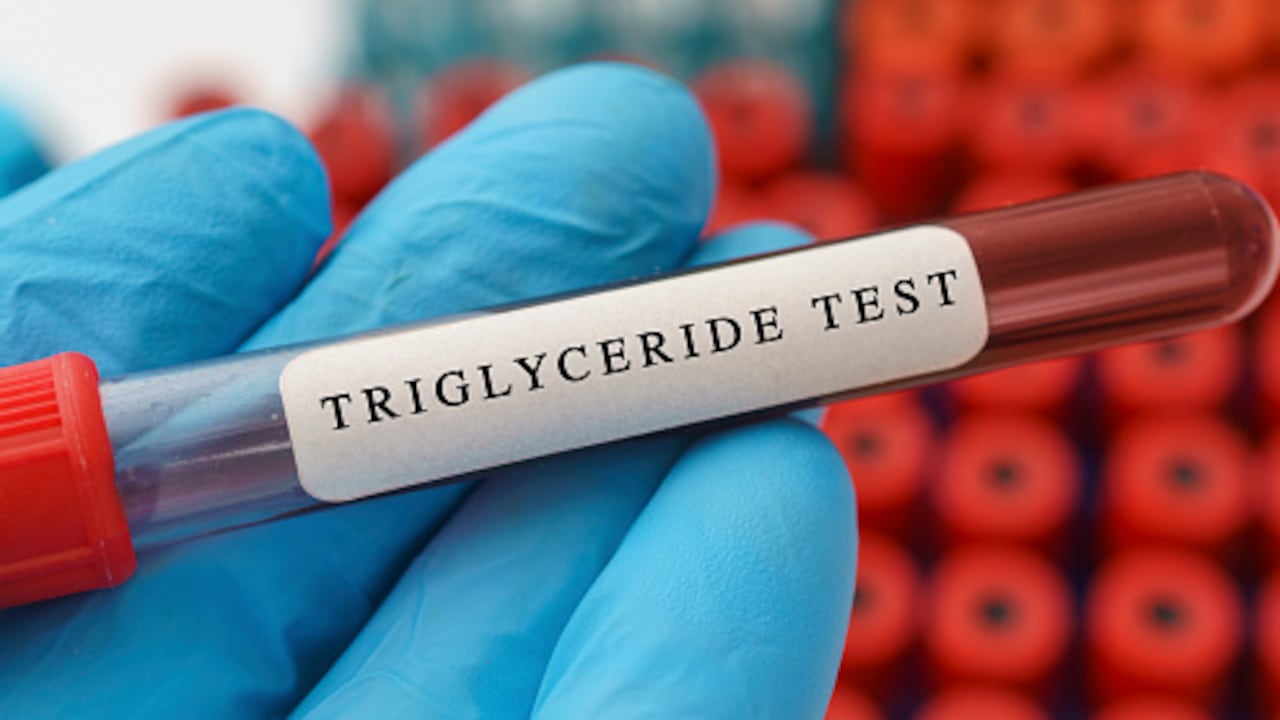 Los triglicéridos altos son perjudiciales para la salud.