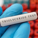 Los triglicéridos altos son perjudiciales para la salud.