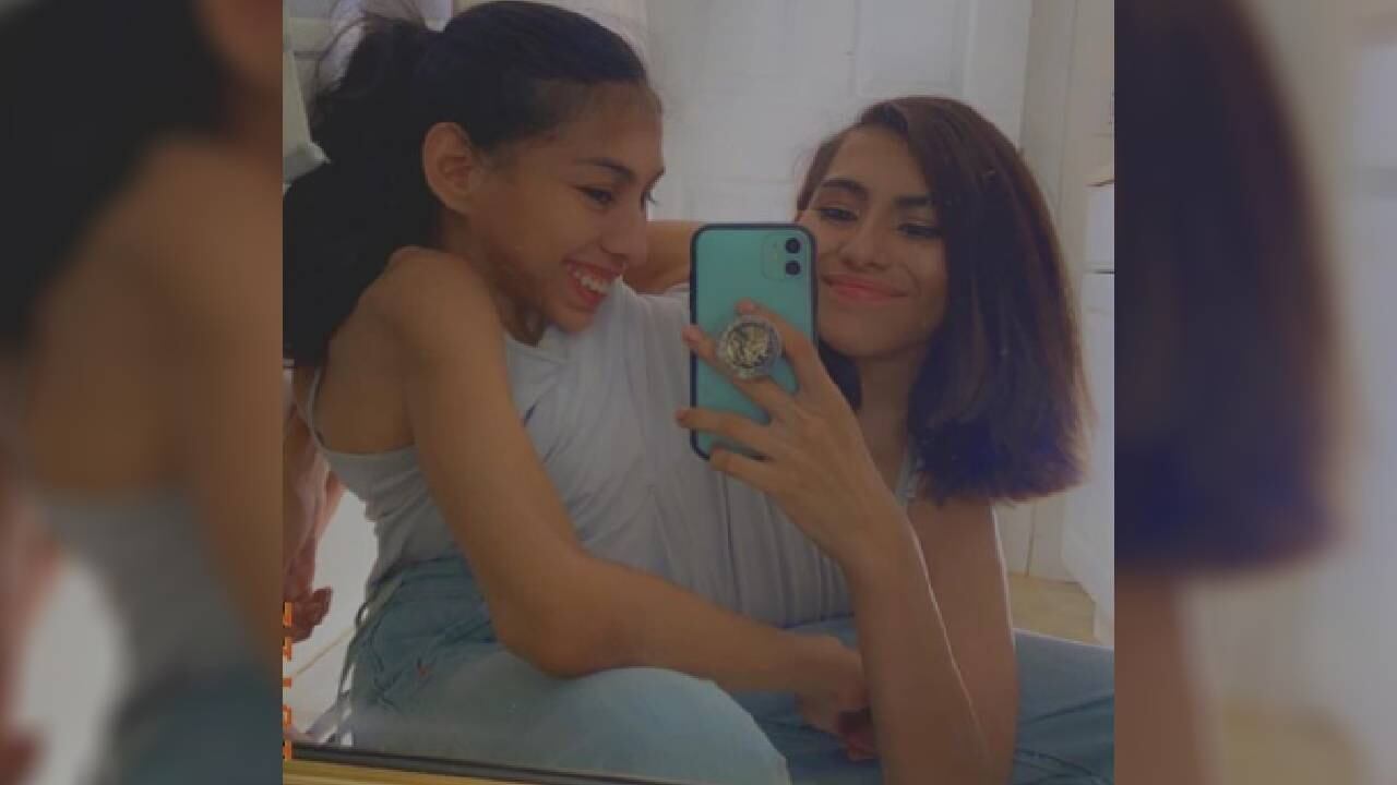 Las siamesas tienen 22 años.