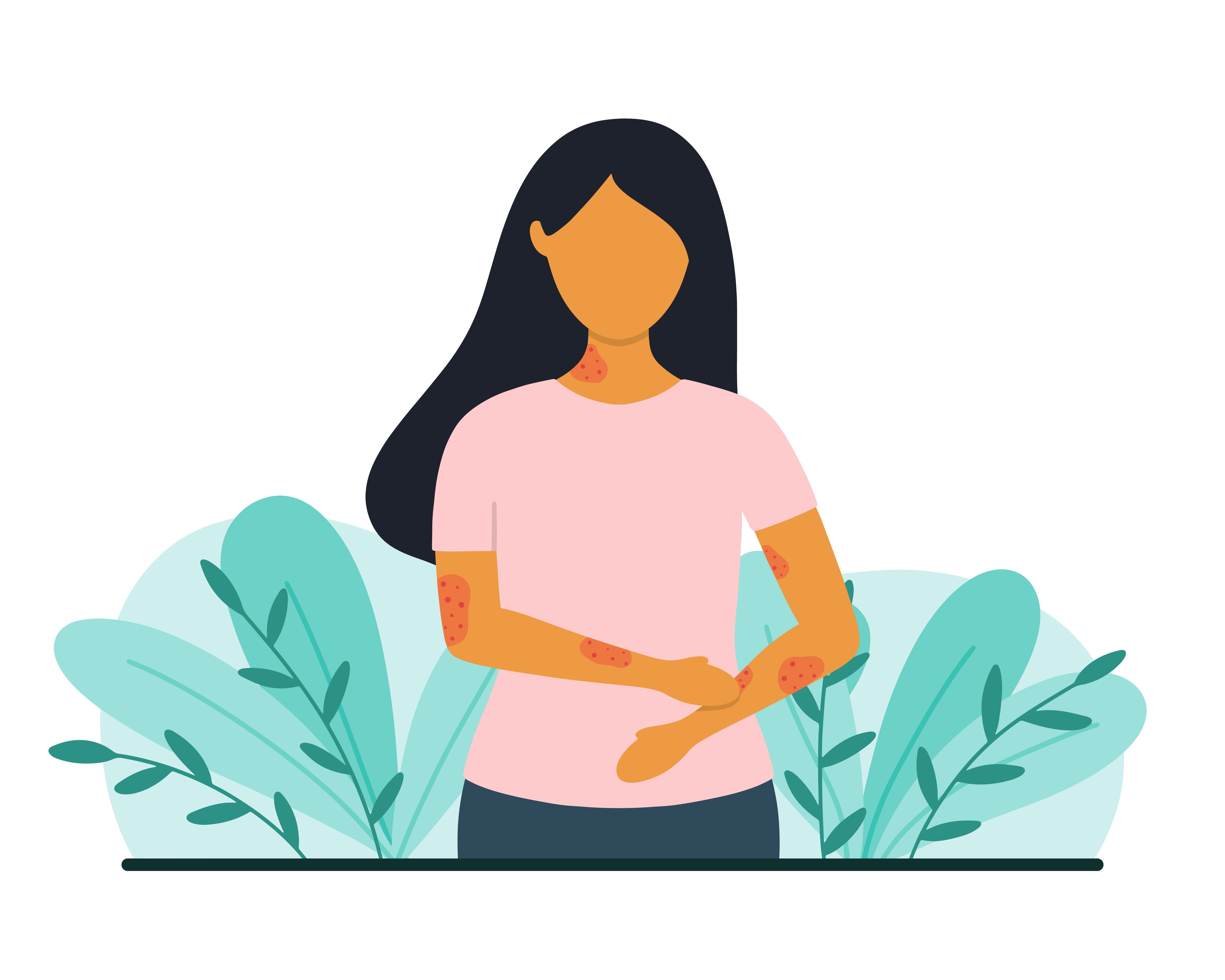 Mujer con problemas de piel. Concepto de psoriasis o eccema. Ilustración de vector de estilo plano.