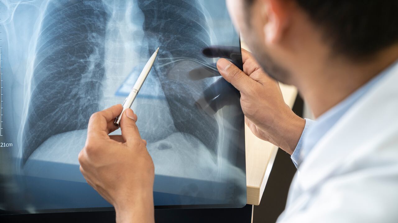 Los pulmones son órganos importantes para el organismo.