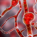 La diabetes es una enfermedad considerada por los especialistas como una afección crónica e irreversible del metabolismo de larga duración, debido al exceso de azúcar o glucosa en la sangre y en la orina.