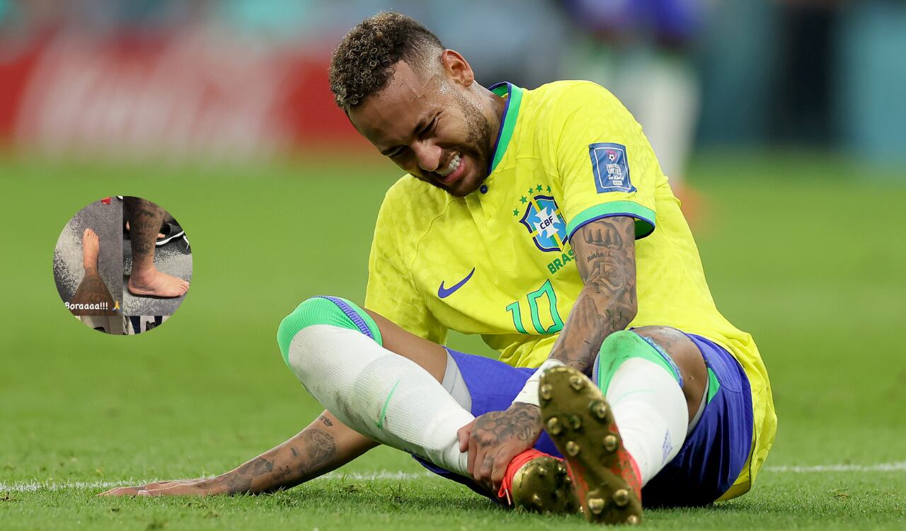 Neymar mostró su tobillo tras algunos días de su lesión.