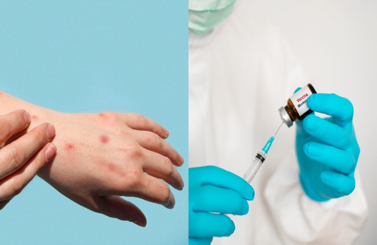 Esto fue lo que dijo la OMS.