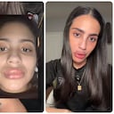 La influencer Hillary denunció que fue víctima de un mal procedimiento estético.