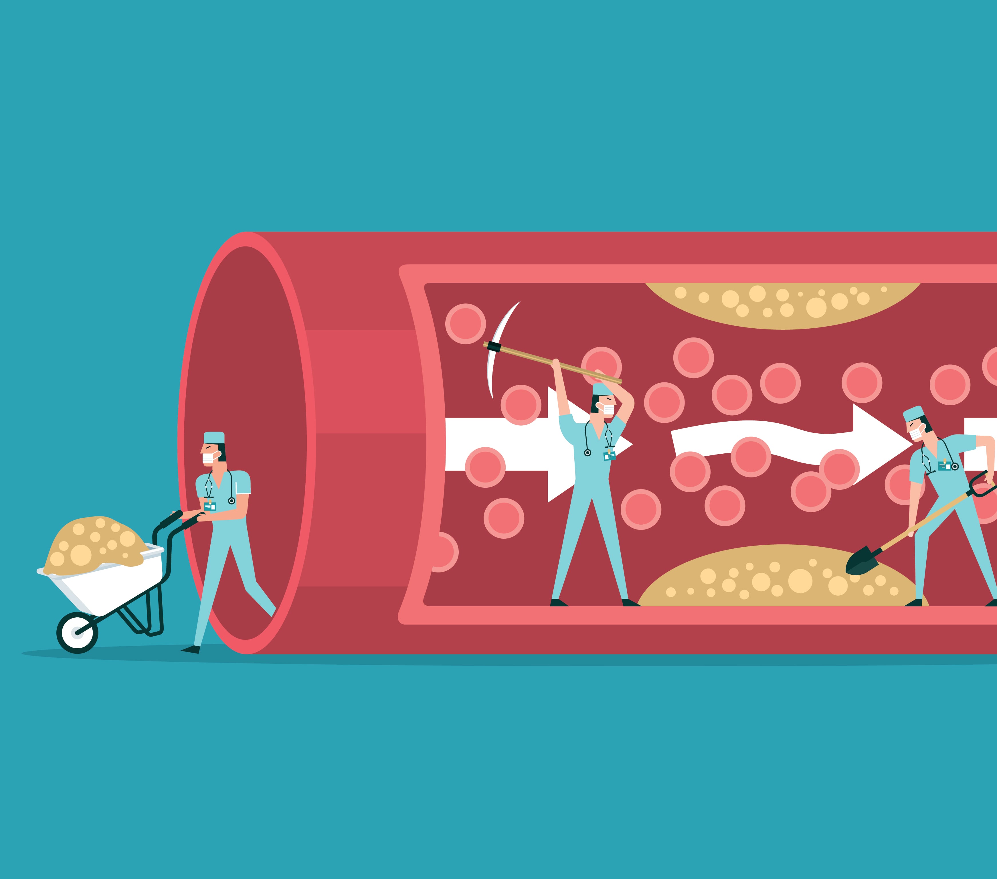 Equipo de médicos diagnostican vasos sanguíneos humanos