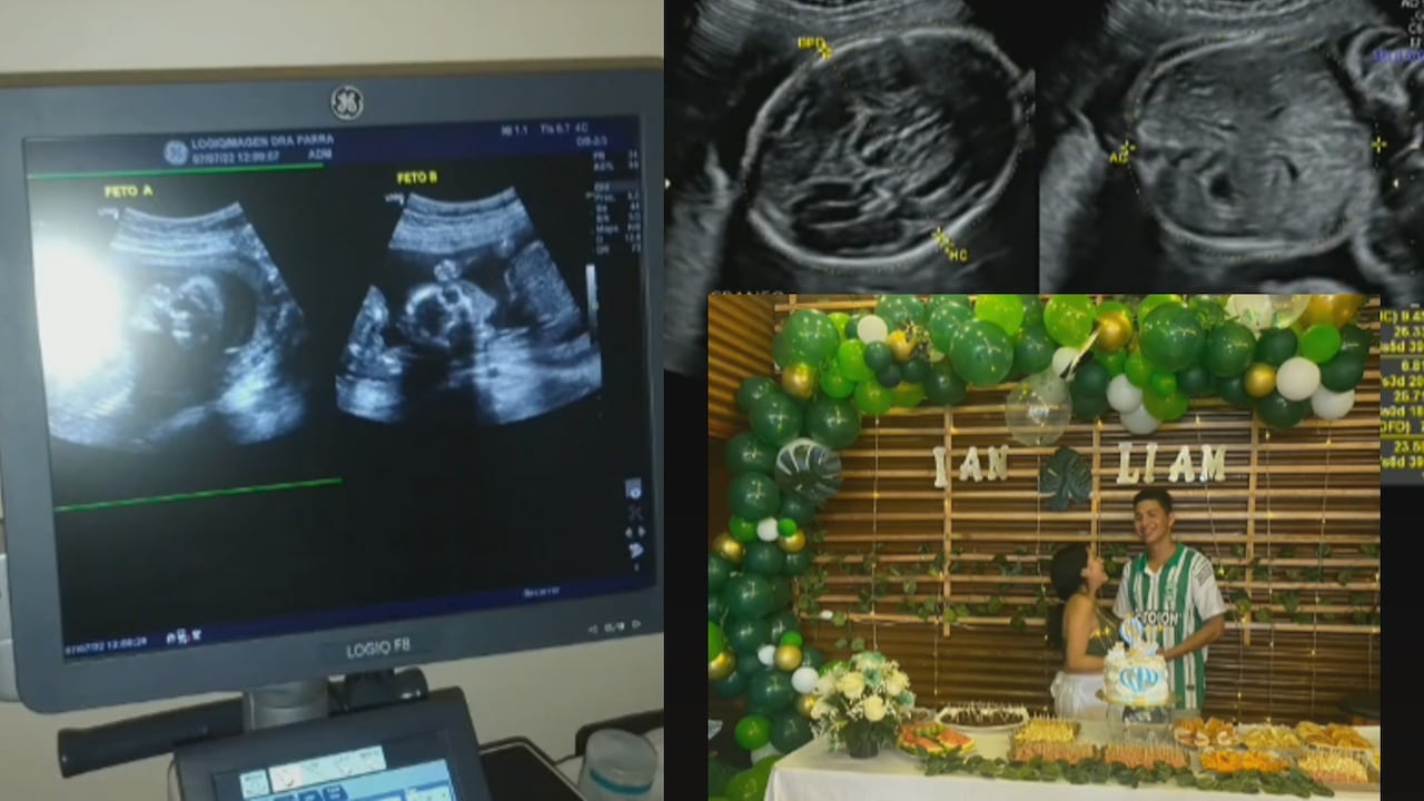 La mujer compartió sus ecografías en TikTok.