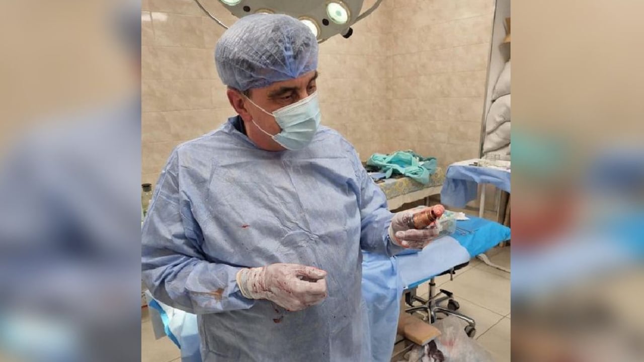 La cirugía representaba un gran riesgo en tanto la granada estaba sin estallar.