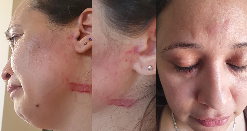 Grey denunció formalmente a Alí Waked ante las autoridades libanesas por agresión física y otros delitos. Como prueba, presentó estas fotografías, donde se denotan múltiples laceraciones y y hematomas en su rostro.
