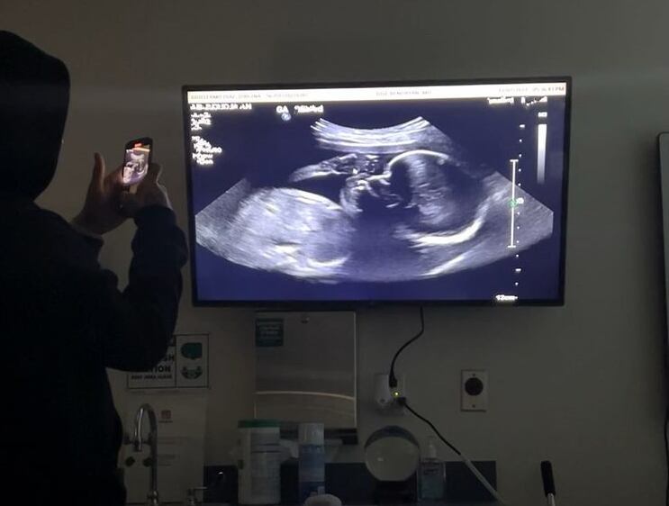 Ecografía de Yailin la más viral