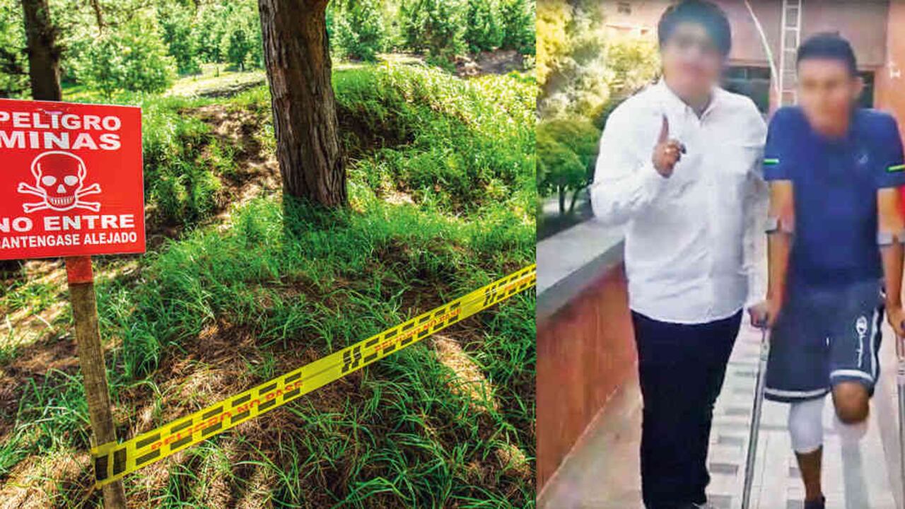 Jeison, un joven de 22 años, pisó una mina antipersonal en el Catatumbo. Su historia refleja las dificultades sufridas por quienes sobreviven a esta tragedia.
