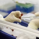 La enfermedad neumocócica es una de las principales causas de muerte infantil, y provoca 1,6 millones de decesos por año.