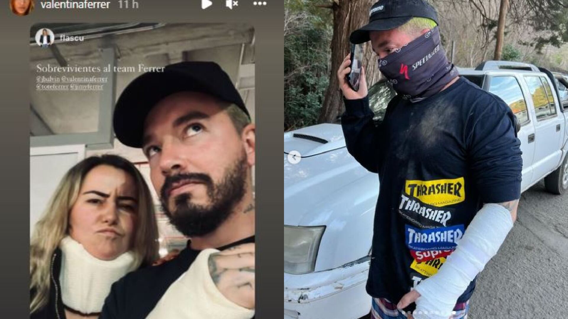 J Balvin tuvo que ser enyesado Foto: Instagram @valentinaferrer