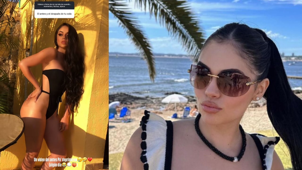 La creadora de contenido se sinceró con respecto a los daños que le causaron los biopolímeros.