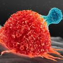 El truco para reducir el riesgo de cáncer.