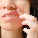 Dolor de canker en la mujer labio superior