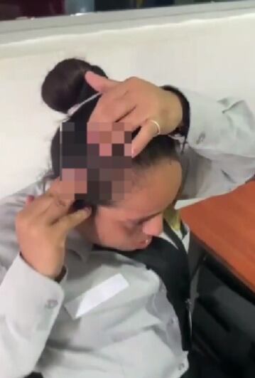 La guardia de seguridad herida con una piedra en la cabeza