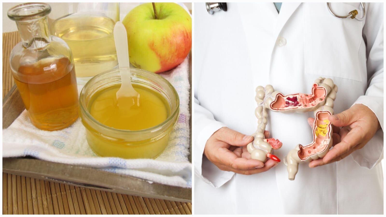 Pese a que los remedios caseros tienen múltiples beneficios para el organismo, no sustituyen la atención médica de ser necesario.