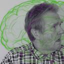 Alzhéimer: se podría diagnosticar 20 años antes de presentar síntomas